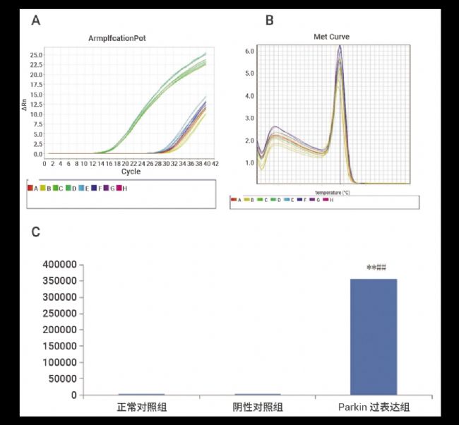 实验操作 | 质粒构建、转化、提取、鉴定、转染、测定(完整版)| MedChemExpress (MCE)