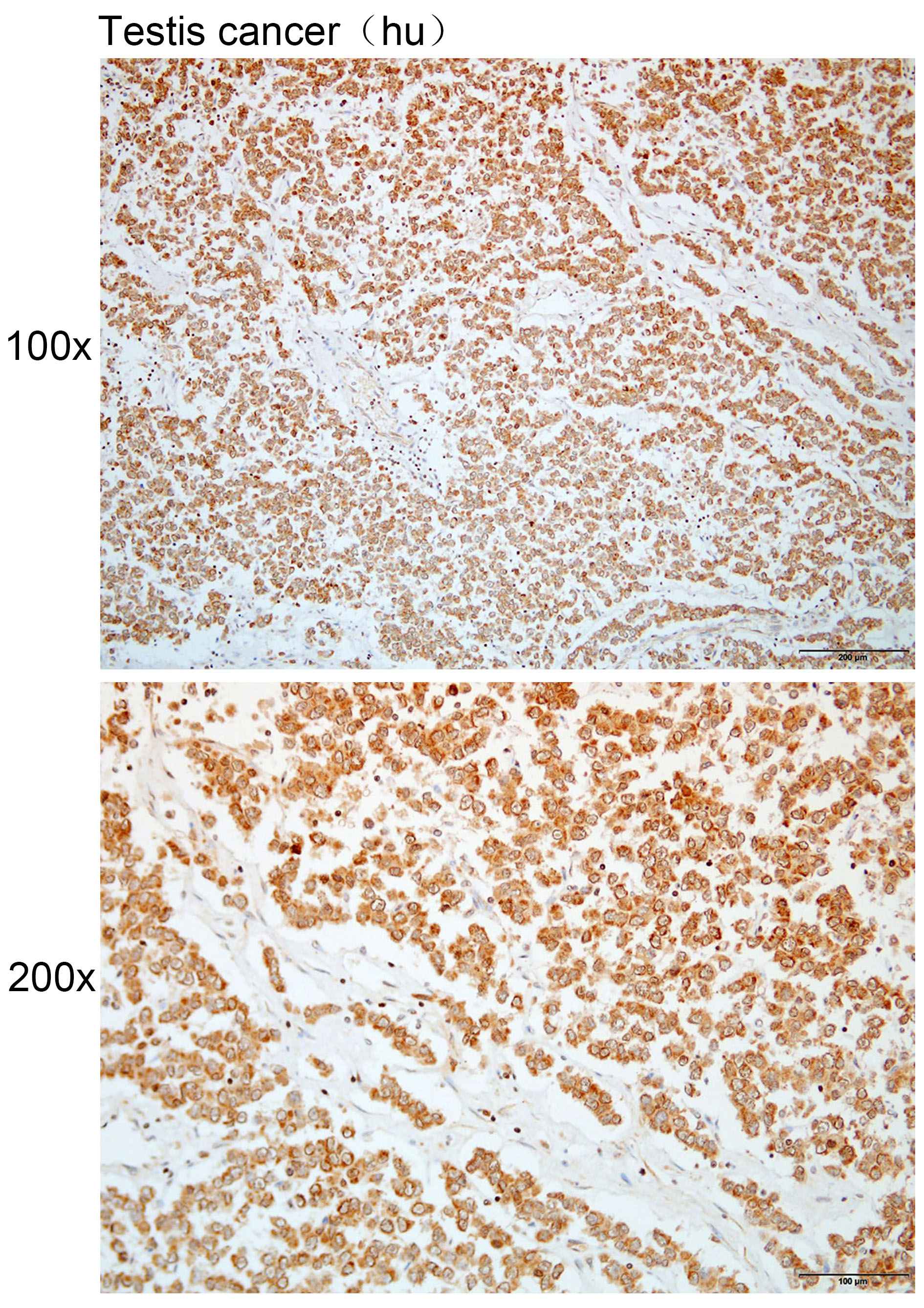 Anti-AP1S3 Polyclonal Antibody