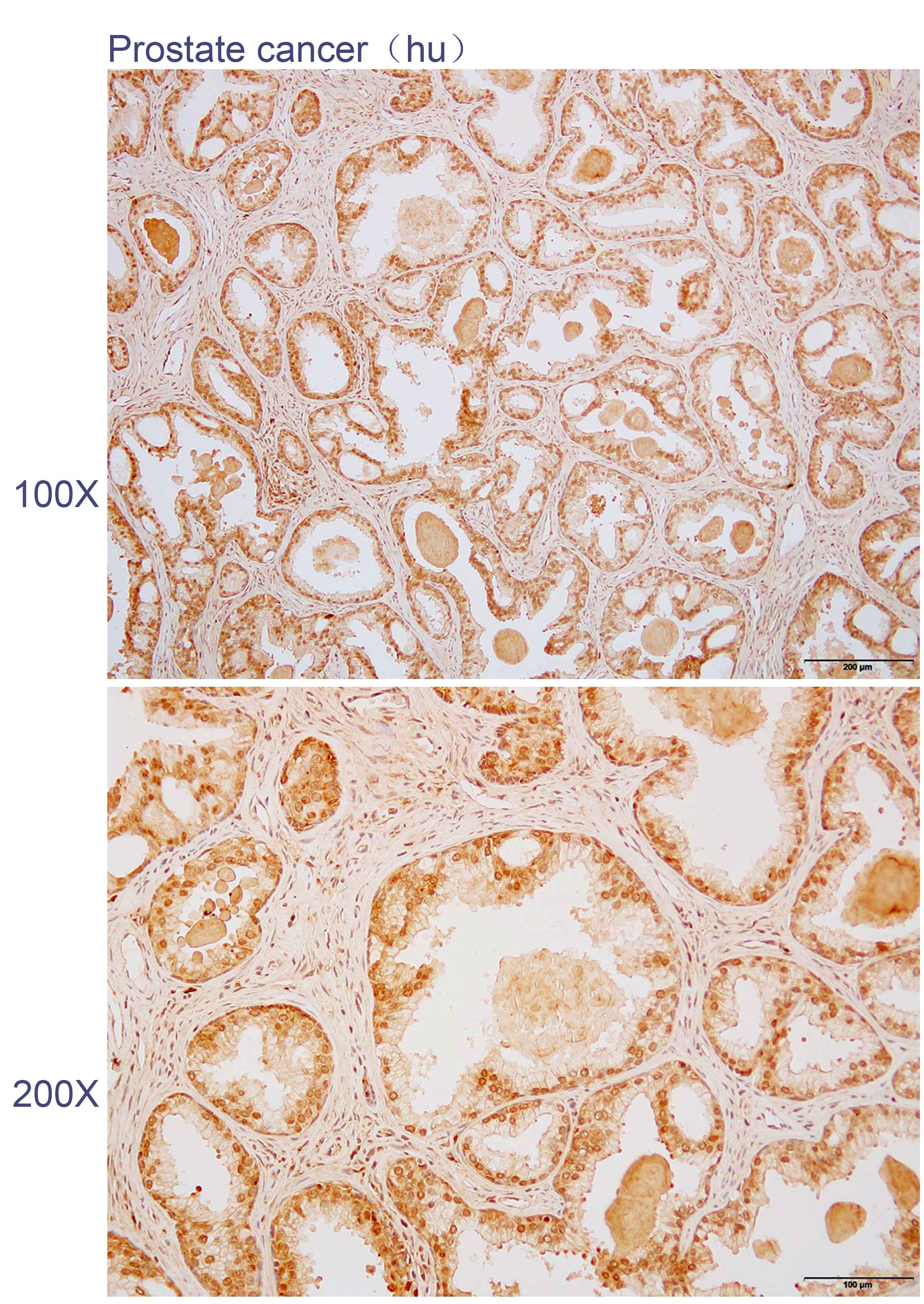 Anti-AP3B1 Polyclonal Antibody