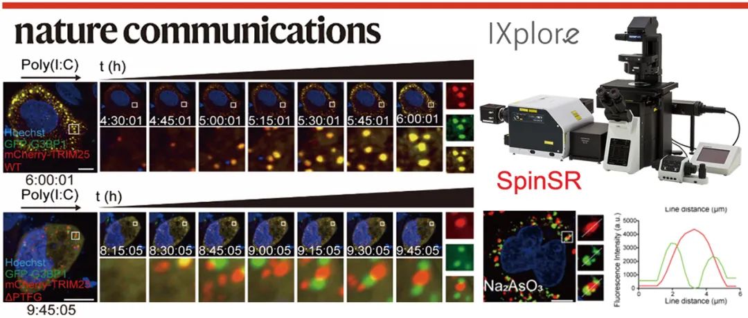 科技前沿 | EVIDENT共聚焦/超分辨助力Nature Communications发文揭示应激颗粒亚型鉴定范式