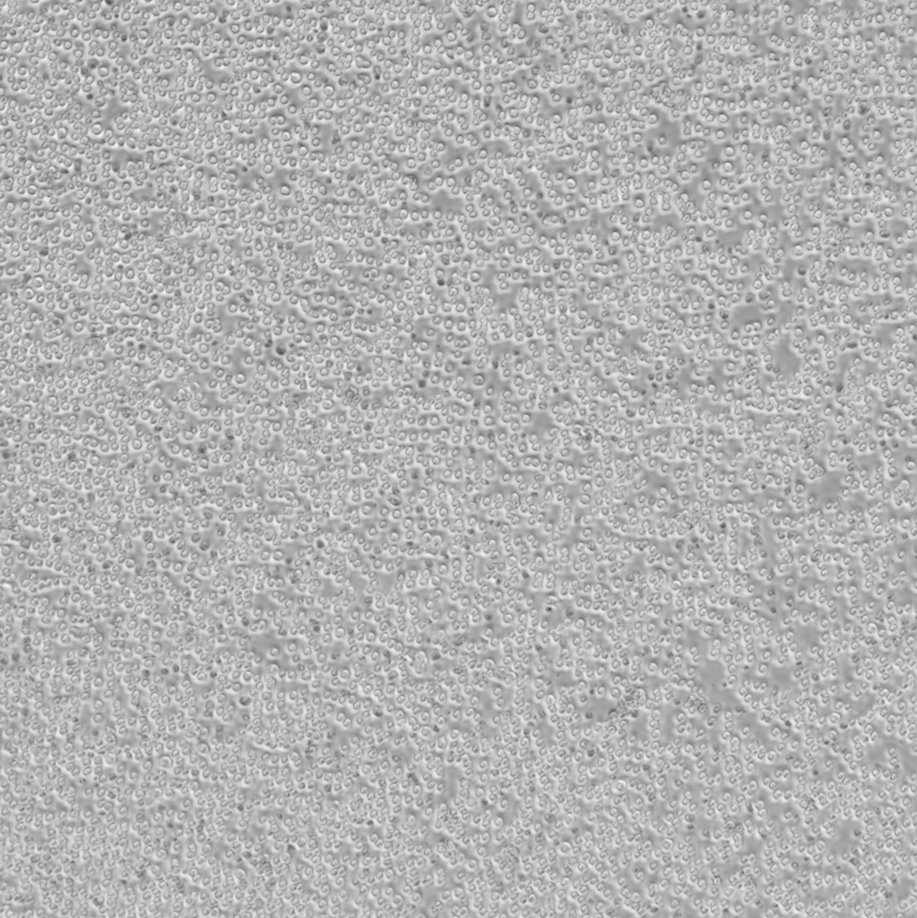 DOHH2_弥漫性大B细胞淋巴瘤细胞