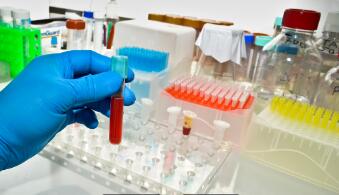 ELISA免疫学实验封闭剂特性简述