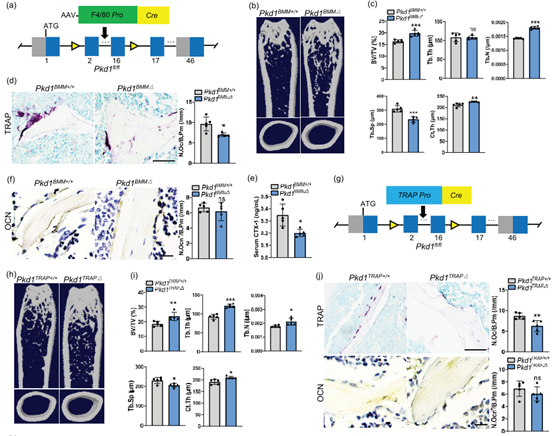 IF=18.9丨骨质疏松药物靶点重要发现