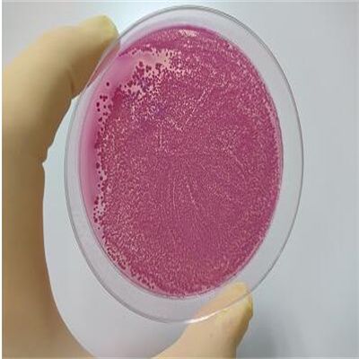 葡萄糖肉汤培养基(0.5%)