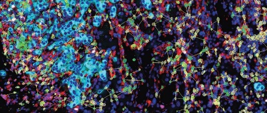 国自然热点——可变剪接分析中的Tissue Cytometry技术应用