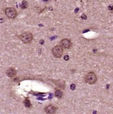 肿瘤/睾丸抗原117