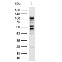 β-肌动蛋白/β-Actin(内参)抗体