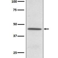 CD38 Rabbit mAb