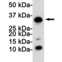 CD8 alpha