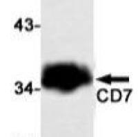CD7
