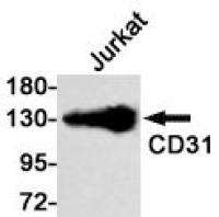 CD31 Rabbit mAb