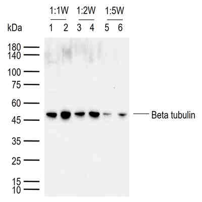 恶性肿瘤丢失蛋白EPLIN抗体