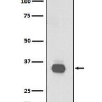 CD20 Rabbit mAb