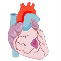 心肌梗死小鼠模型