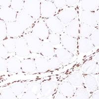 检测实验丨免疫组化(IHC)实验