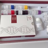 小鼠胺氧化酶B(MAOB)酶联免疫试剂盒