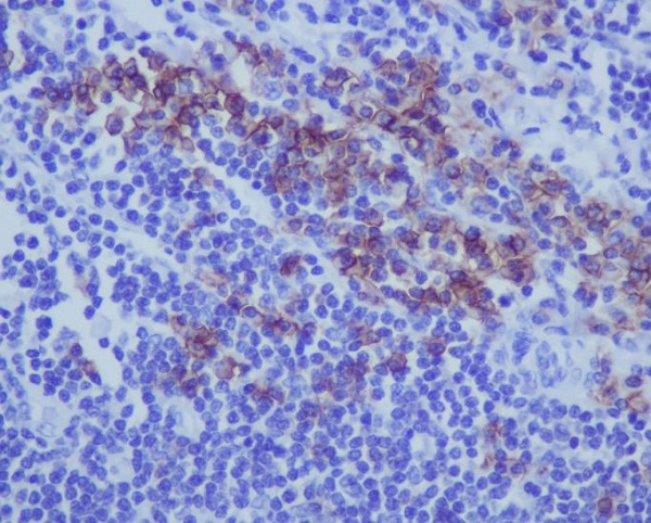CD38 Rabbit mAb