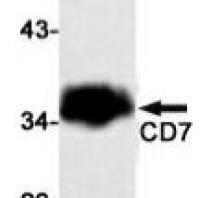 CD7