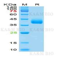 抗志贺毒素大肠杆菌O139抗体（仔猪水肿病志贺毒素大肠杆菌O139）