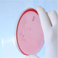 GAL4系统酵母双杂培养基套装+(含AbA,X-α-gal)