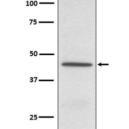CD38 Rabbit mAb