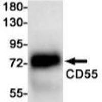 CD55