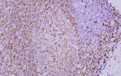 CD74 Mouse mAb