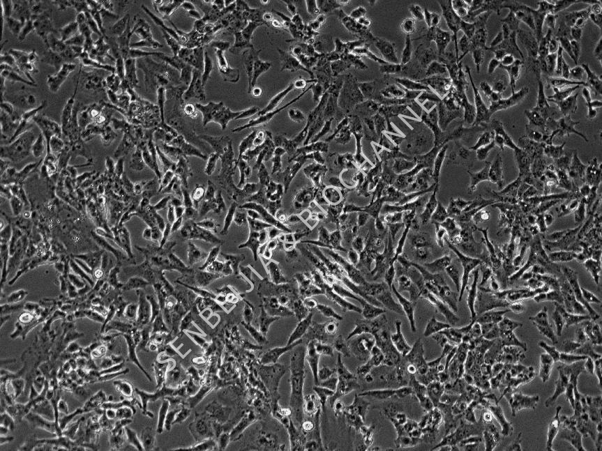 什么是细胞分化，分化应该如何处理？