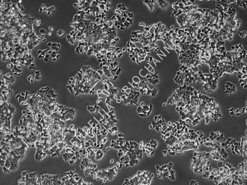 什么是细胞分化，分化应该如何处理？