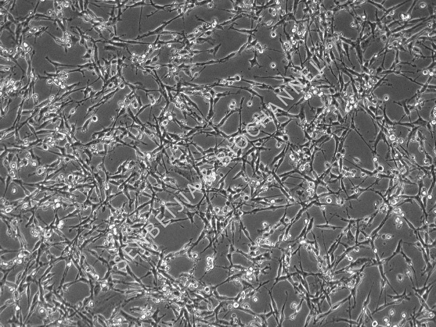 什么是细胞分化，分化应该如何处理？
