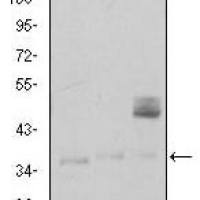 Mouse Monoclonal Antibody to CD1A
