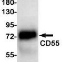 CD55