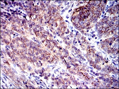 Mouse Monoclonal Antibody to C