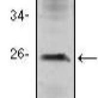 Mouse Monoclonal Antibody to CD3E