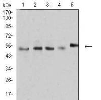 Mouse Monoclonal Antibody to CD2