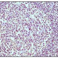 Mouse Monoclonal Antibody to CD19