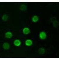 Mouse Monoclonal Antibody to CD20