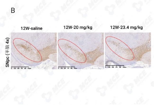 实验操作 | 帕金森病造模方法盘点 & 技巧全解析！| MedChemExpress (MCE)