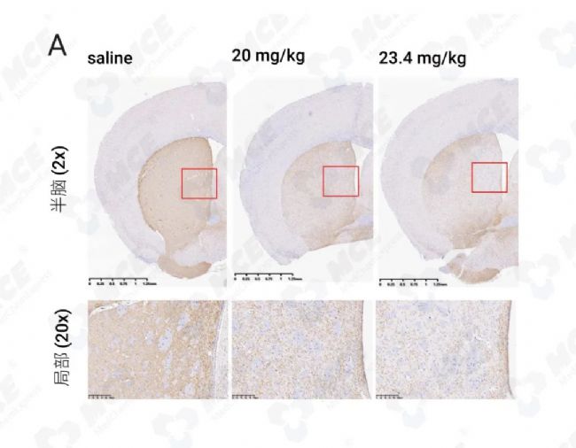 实验操作 | 帕金森病造模方法盘点 & 技巧全解析！| MedChemExpress (MCE)