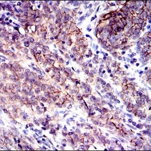 Mouse Monoclonal Antibody to CD9