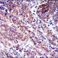 Mouse Monoclonal Antibody to CD9