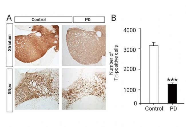 实验操作 | 帕金森病造模方法盘点 & 技巧全解析！| MedChemExpress (MCE)
