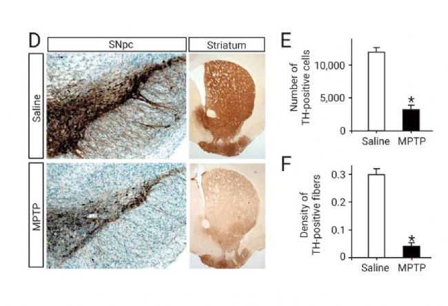 实验操作 | 帕金森病造模方法盘点 & 技巧全解析！| MedChemExpress (MCE)