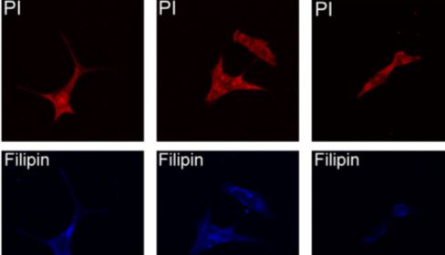 脂质染色 | 脂滴-胆固醇染色技术全攻略