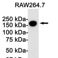 Rabbit Monoclonal Antibody to CD11b