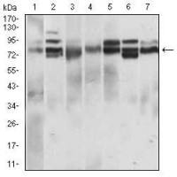 Mouse Monoclonal Antibody to CD22