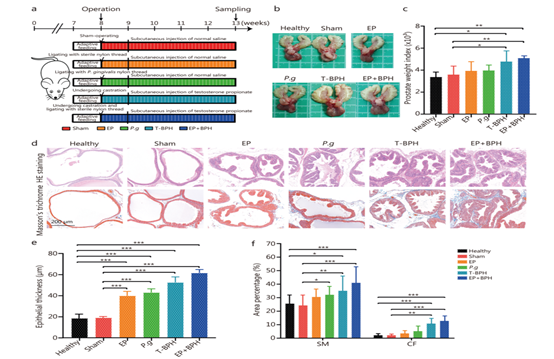 牙龈卟啉单胞菌通过IL-6/IL-6R加剧良性前列腺增生