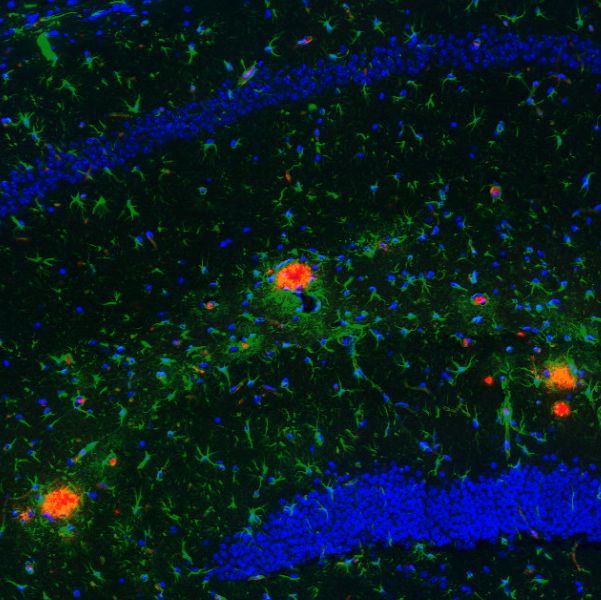 检测实验丨免疫荧光(IF)实验