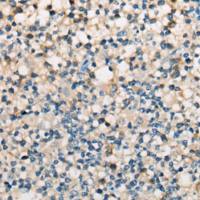 Rabbit Polyclonal Antibody to CD28