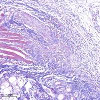 检测实验丨Masson染色实验